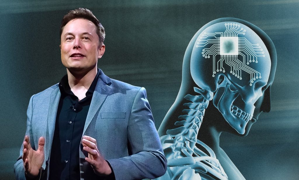 Elon Musk's Neuralink Marks Milestone with First Human Brain Implant