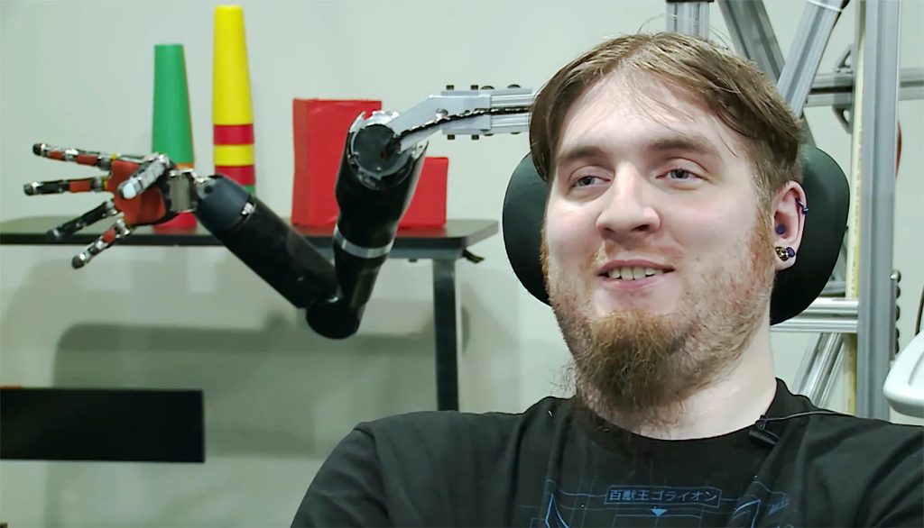 Neuralink Conducts First Human Brain Chip Implant Trial
